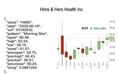 candlestick pattern